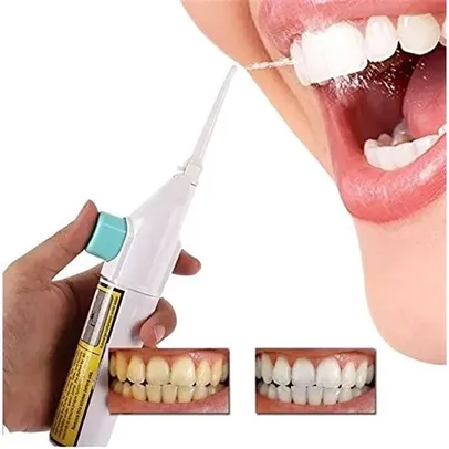 Irrigador Oral Dental Bucal Jato Limpeza Dente Gengiva Boca Aparelho Fio Dental Água Manual