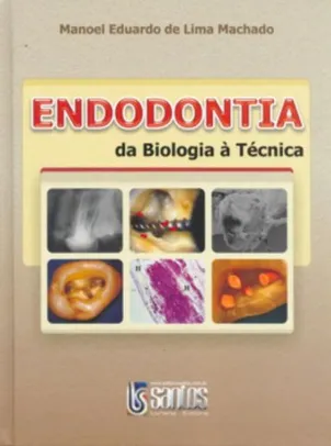 Endodontia. Da Biologia a Técnica | Capa dura | R$230